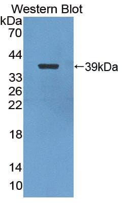 NFKB2 Antibody (aa37-342, PE)