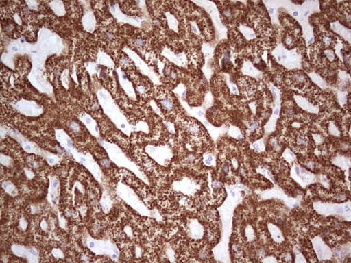 ABAT Antibody (aa29-323, clone OTI3D2)