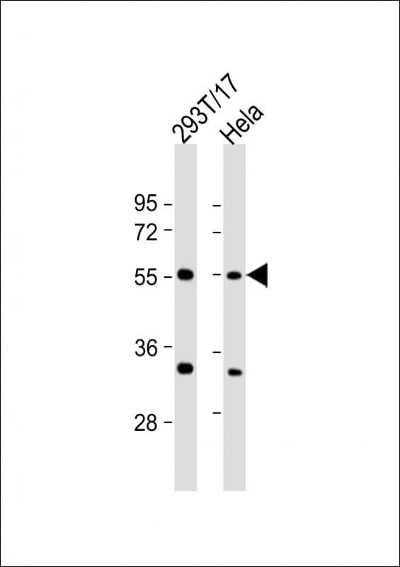 AAAS / Adracalin Antibody (aa395-425)