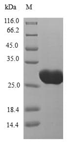 Human CT83 / CXorf61 Protein (Recombinant 6His-B2M, N-terminus)