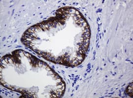 Monoclonal Mouse anti-Human CDH1 / E Cadherin Antibody (clone OTI2F9, IHC, WB)
