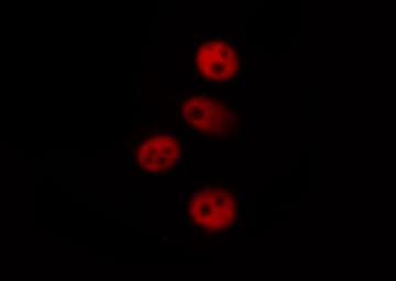 MAPKAPK5 / PRAK Antibody (phospho-Thr182)