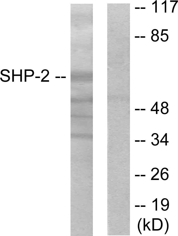 IHC-plus™ PTPN11 / SHP-2 / NS1 Antibody (aa508-557)