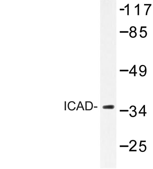 DFFA / ICAD / DFF45 Antibody (Gln177)