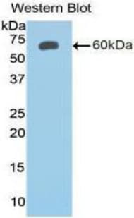IGFBP2 / IGF-BP53 Antibody (aa24-305)
