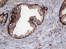 PAI-RBP1 / SERBP1 Antibody (clone OTI5G2)