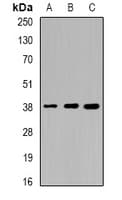 SORD / Sorbitol Dehydrogenase Antibody