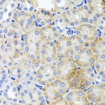 Polyclonal Rabbit anti-Human PEX3 Antibody (IHC, WB)