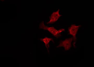 Polyclonal Rabbit anti-Human AKT1 Antibody (phospho-Ser129, IF, WB)