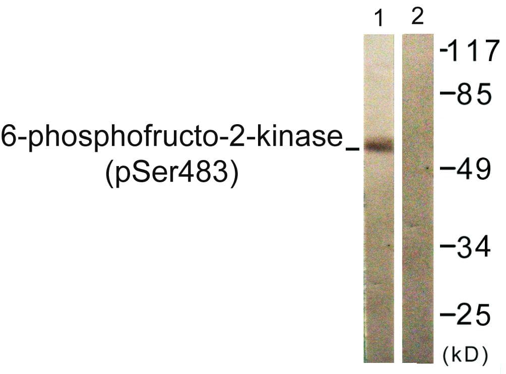 PFKFB2 Antibody (phospho-Ser483)