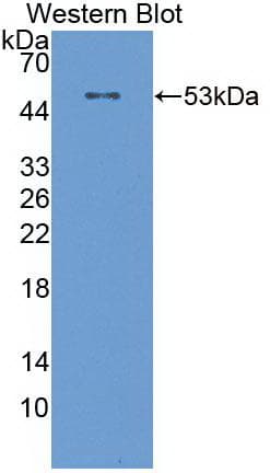 NT5E / eNT / CD73 Antibody (Biotin)