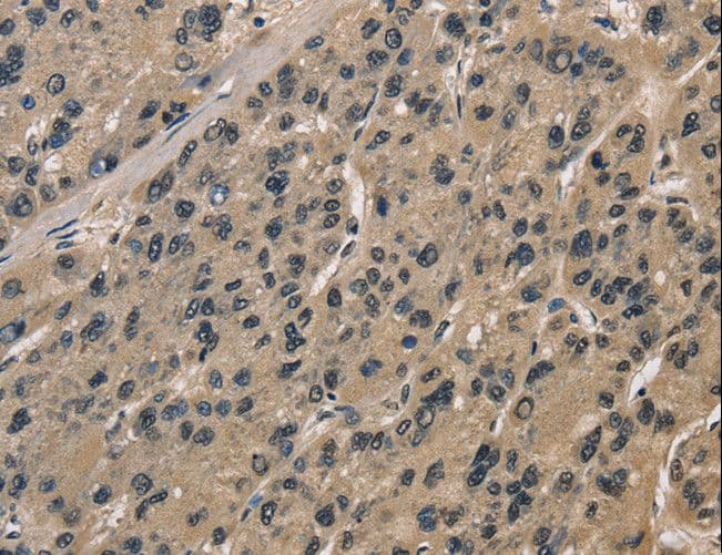 Polyclonal Rabbit anti-Human DIS / CCAR1 Antibody (IHC)