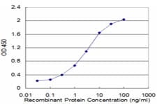 Monoclonal Mouse anti-Human RP2 Antibody (clone 1B4, WB)