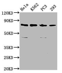ASUN / C12orf11 Antibody