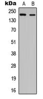 NUP210L Antibody (Internal)