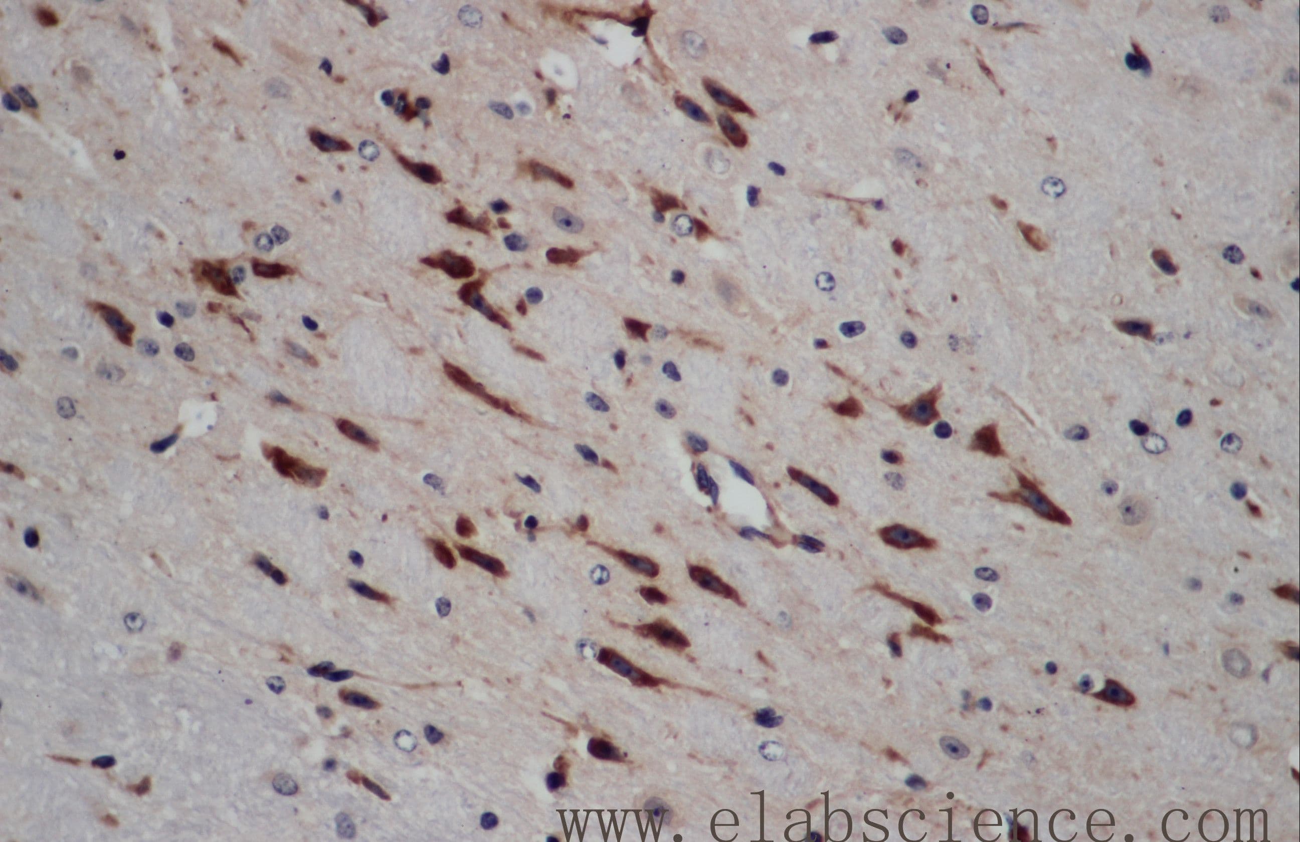 Polyclonal Rabbit anti-Human ERG Antibody (IHC, WB)