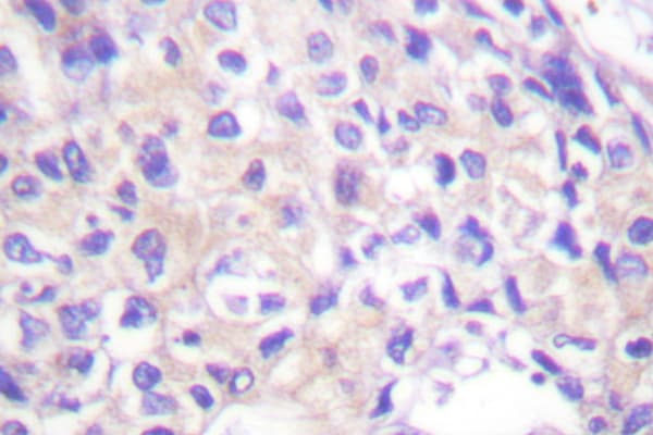 RPS6KA1 / RSK1 Antibody (Gln374)