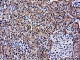 KCTD14 Antibody (clone OTI3A4)