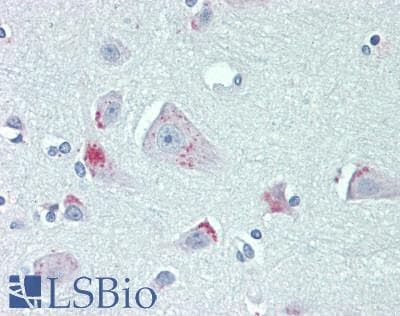 G2E3 / KIAA1333 Antibody (aa226-252)