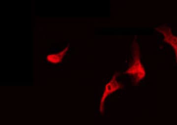 Polyclonal Rabbit anti-Human NBPF7 Antibody (IF, WB)