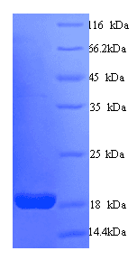 Human CALM1 / Calmodulin Protein (Recombinant His)