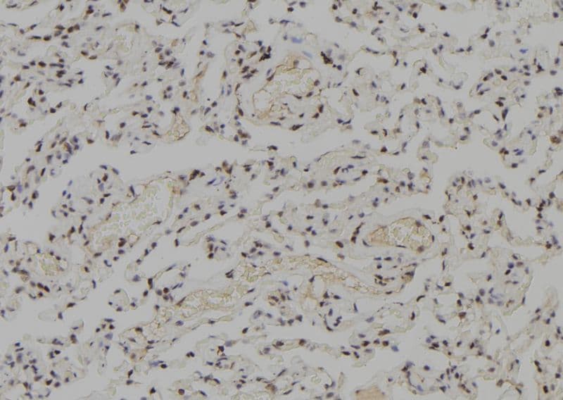 WRN Antibody