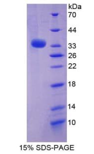 Mouse STAM1 / STAM Protein (Recombinant His, N-Terminal)