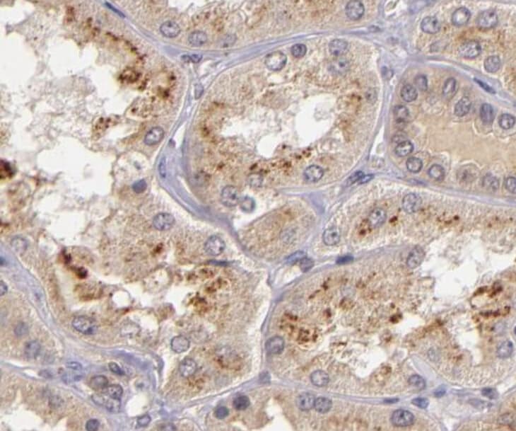 Polyclonal Rabbit anti-Human NOS2 / iNOS Antibody (IHC, IF, WB)