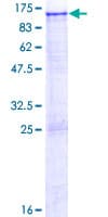 Human ITIH1 Protein (Recombinant GST)