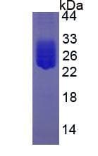 Human IL6 / Interleukin 6 Protein (Recombinant)