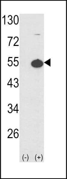 PRKAR1A Antibody (aa1-30)