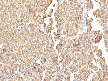 CHGA / Chromogranin A Antibody (clone LK2H10 + PHE5, Ready-to-Use)