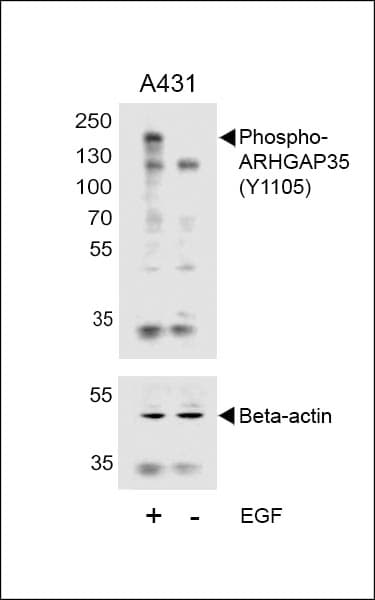 ARHGAP35 / GRLF1 Antibody (Tyr1105)