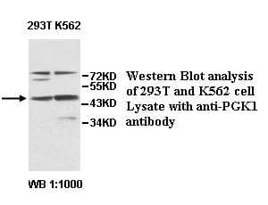 PGK1 / Phosphoglycerate Kinase Antibody (aa57-308)