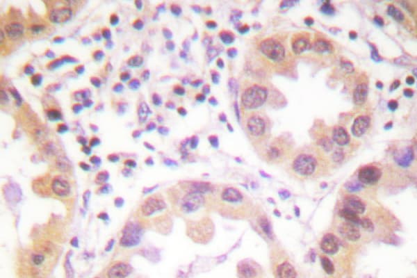 NEDD8 Antibody (Asp21)