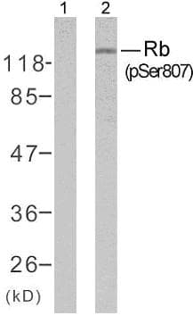 Polyclonal Rabbit anti-Human RB1 / Retinoblastoma / RB Antibody (phospho-Ser807, IHC, WB)