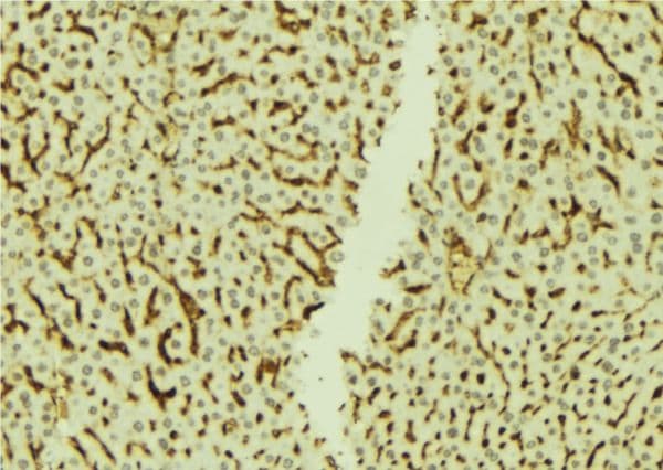 NRIP1 / RIP140 Antibody
