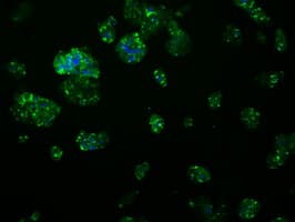 APP / Beta Amyloid Precursor Antibody (clone OTI3D11)