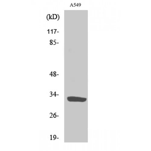 SLC39A9 Antibody (70-150 aa, Internal)