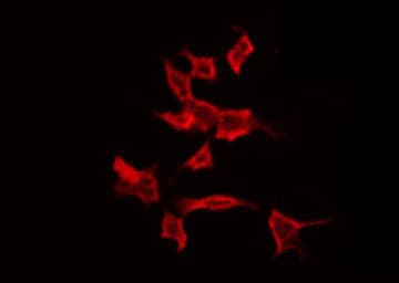 Polyclonal Rabbit anti-Human ARRDC4 Antibody (IF, WB)