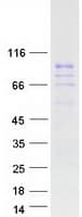 Human ZNF496 / NZIP1 Protein (Recombinant Myc-DDK (Flag))