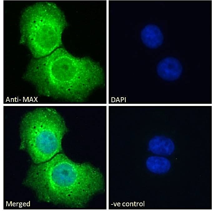 PathPlus™ MAX Antibody (aa147-160)