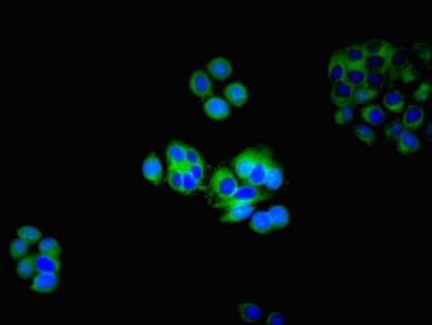 Polyclonal Rabbit anti-Human HTR2A / 5-HT2A Receptor Antibody