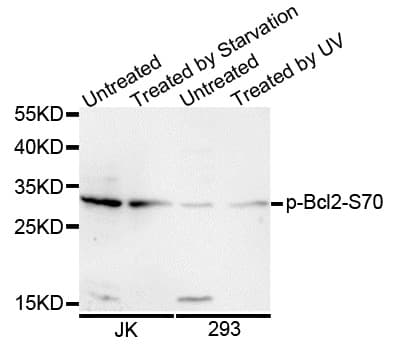 BCL2 / Bcl-2 Antibody (phospho-Ser70)