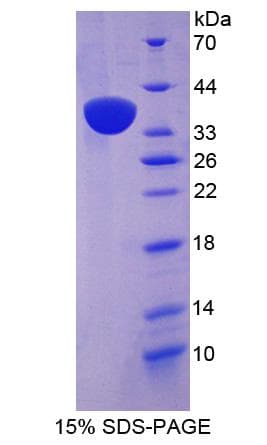 Human SYNE2 / Nesprin-2 Protein (Recombinant His-S)