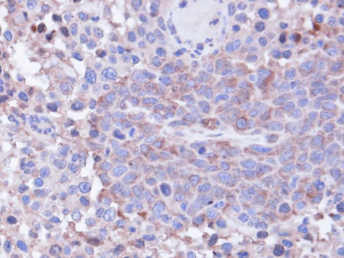 PPP1CC / PP1 Gamma Antibody (aa2-227)