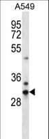 CDRT15L2 Antibody (aa134-162)
