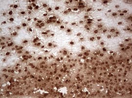 Monoclonal Mouse anti-Human NUMB Antibody (clone OTI2E8, aa1-365, IHC, WB)