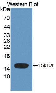 TCHH / Trichohyalin Antibody (aa1851-1943)