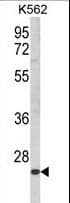 IHC-plus™ KLRC2 / NKG2C / CD159c Antibody (aa1-30)